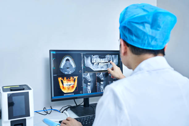 Best Emergency Root Canal Treatment in Westlake Vlage, IL